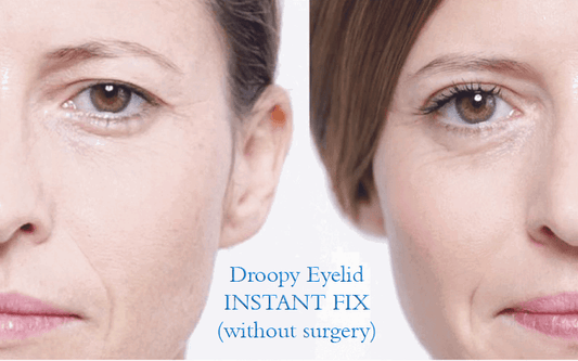One eyelid is drooping (Ptosis) - Here is what you can do!