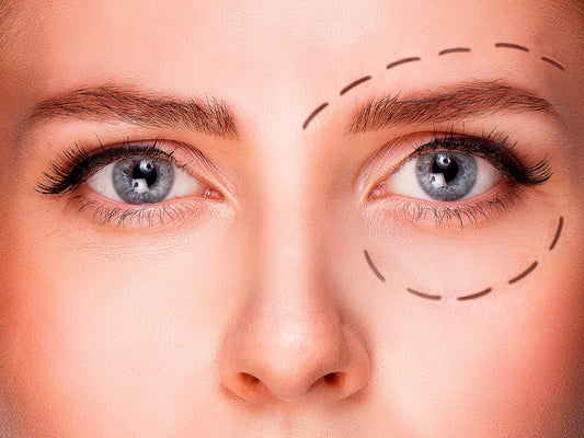 BOTOX Injection Most Common Side Effect: Droopy Eye Lids! Here Is What You Can Do.